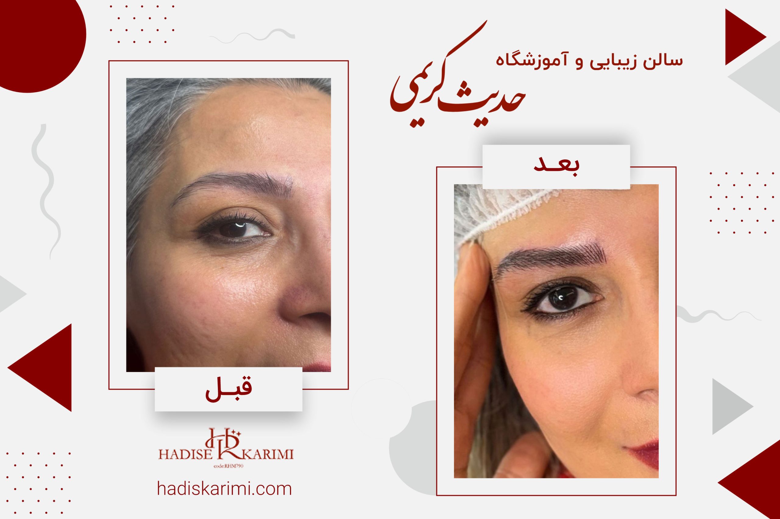 میکروبلیدینگ ابرو زنجان – نحوه انجام میکروبلیدینگ